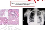 Курение вейпов – бич современности Курение вейпов – бич современности