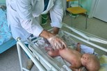 Хирурги Областной детской клинической больницы спасают новорожденных детей с редким пороком развития
